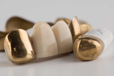 Permanent Gold Teeth (History, Cost, Pros Permanent Gold Teeth, Car Expensive, Tooth Crown, Teeth Caps, Tooth Cavity, Tooth Filling, Gold Grill, Front Teeth, Gold Teeth