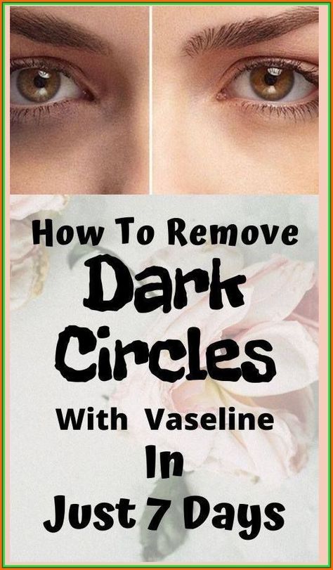 REMOVE DARK CIRCLES UNDER EYES IN 7 DAYS !!! Vaseline Under Eyes, Dark Underarms, Homemade Facials, Remove Dark Circles, Under Eyes, Dark Circles Under Eyes, Daily Health Tips, Perfect Eyebrows, Unwanted Hair Removal