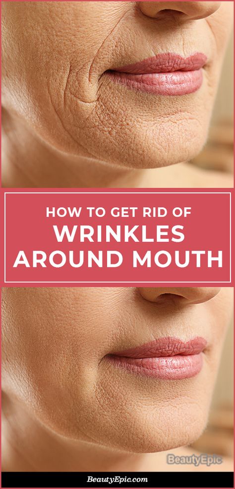 How To Reduce Wrinkles Around The Mouth Naturally? Home Remedies For Wrinkles, Mouth Wrinkles, Get Rid Of Wrinkles, Wrinkle Remedies, Lip Wrinkles, Forehead Wrinkles, Skin Care Wrinkles, Face Wrinkles, Facial Exercises