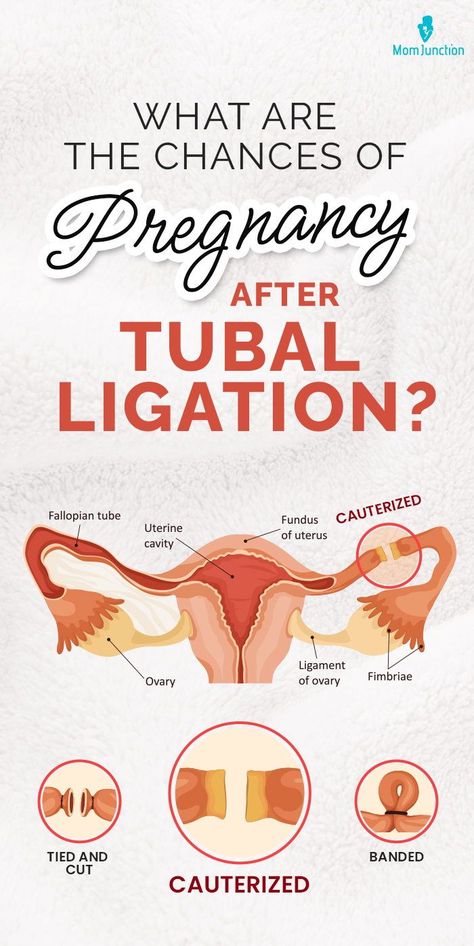 Tubal Reversal Surgery, Tubal Removal Recovery, Tubal Litigation Recovery, Pregnancy After Tubal, Tubal Reversal, Symptoms Of Pregnancy, Blocked Fallopian Tubes, How To Conceive, Chances Of Pregnancy