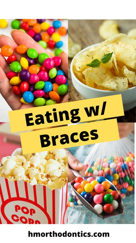 Snacks For Braces Ideas, New Braces Care Package, Braces Gift Basket, Soft Snacks For Braces, Braces Party Ideas, Best Food For Braces, Braces Friendly Snacks, Braces Care Package, Braces Off Gift Basket