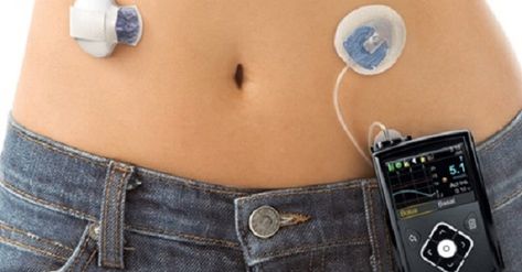 Kidney Damage, Insulin Pump, Glucose Levels, Regulate Blood Sugar, Type 1, Disease, Engineering, Pumps