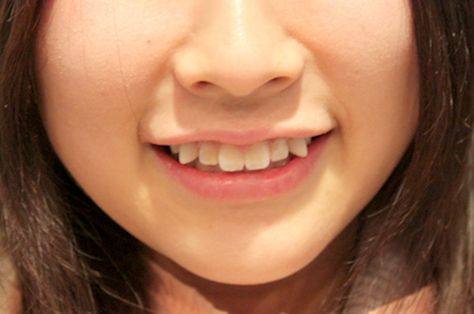 Japan’s Latest Beauty Trend: Paying Money To “Ruin” Your Teeth Cheek Piercings, Black Teeth, Crooked Teeth, Japanese Cosmetics, Double Eyelid, Photographie Portrait Inspiration, Beauty Standards, Cosmetic Dentistry, Glass Skin