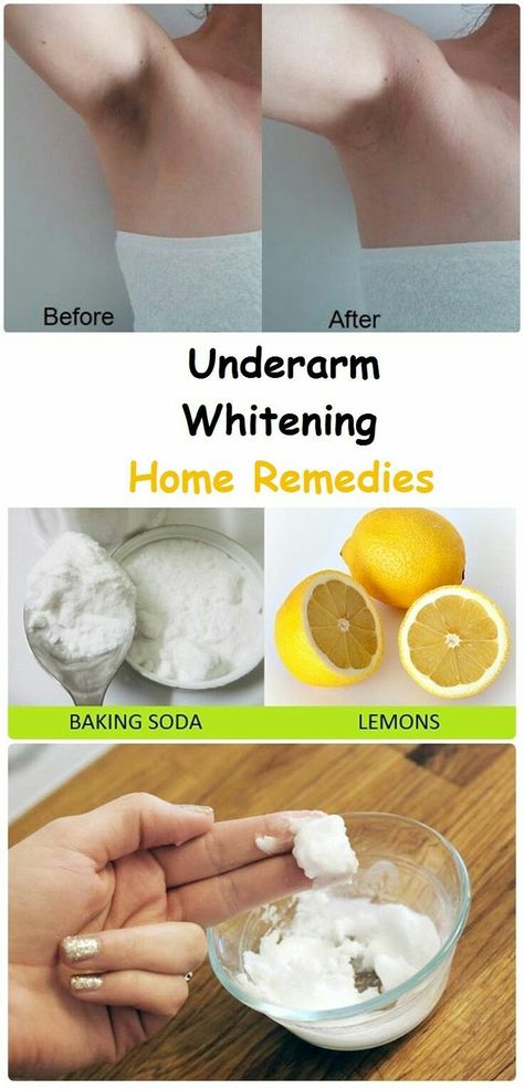 Whiten Underarms Fast, How To Whiten Underarms, Baking Soda And Lemon, Hair Cleanser, Dark Underarms, Baking Soda Uses, Baking Soda Shampoo, Natural Cleanser, Natural Therapy