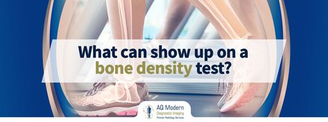 How To Increase Bone Density, Building Bone Density, Bone Density Test, Osteoblast Osteoclast, Bone Fracture, Diagnostic Imaging, Bone Diseases, Standard Deviation, Hormone Levels