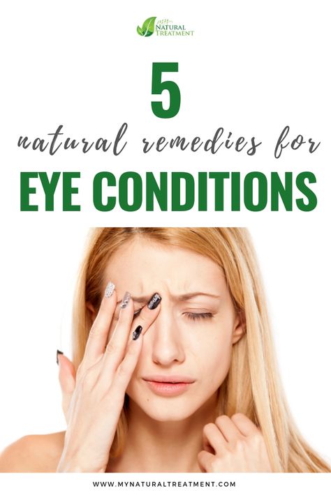 5 Natural Remedies for Eye Conditions with Herbs #eyeconditions #eyeproblems #eyeremedies #healthyeyes #homeremedies #eyesconditions Eye Problems Remedies, Sty In Eye Remedies, Eye Irritation Remedies, Itchy Eyes Remedy, Dry Eye Remedies, Home Remedies For Allergies, Home Remedies For Warts, Eye Conditions, Warts Remedy