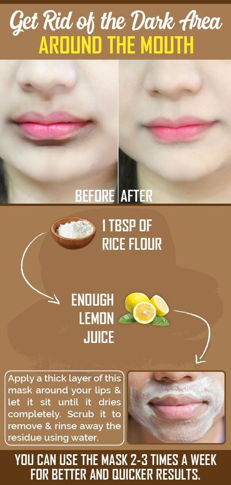 Dark Skin Around Mouth, Remedies For Dark Lips, Natural Skin Care Remedies, Natural Face Skin Care, Lip Care Routine, Good Skin Tips, Skin Care Face Mask, Beauty Tips For Glowing Skin, Perfect Skin Care Routine