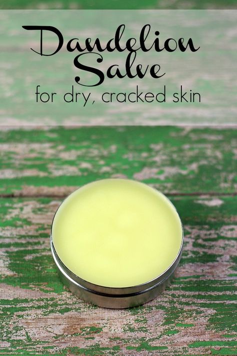 Dandelion Salve Recipes, Homemade Salve Recipes, Diy Dandelion, Dandelion Salve, Homemade Salve, Yard Diy, Salve Recipes, Coconut Oil For Acne, Homemade Moisturizer