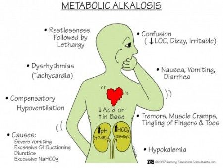 Metabolic Alkalosis Nursing Management Respiratory Alkalosis, Metabolic Alkalosis, Nursing Cheat, Nursing Information, Nurse Manager, Nursing Mnemonics, Nursing School Survival, Nursing School Studying, Nursing School Tips