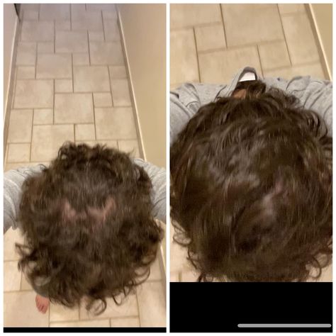 Hi guys I swear Im not a troll I just need opinions. So on the left is my unbrushed hair and on the right is my hair immediately after brushing it. Am I balding or do I have some sort of double crown or cowlick scalp? Cowlick Hair, Double Crown Hairstyles, Celebrity Hair Colors, Hairstyles Women, Women Makeup, Crown Hairstyles, Hi Guys, Celebrity Hairstyles, Brushing