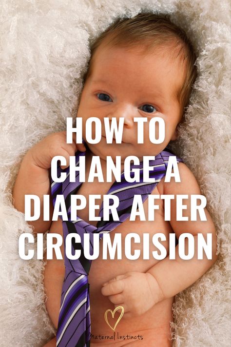 Circumcision for Newborn Boys - How to change a diaper after circumcision via @maternal_instincts Post Circumcision Care, Baby Circumcision Care, Newborn Circumcision Care, Circumcision Care Newborn, Potty Training Baby, Baby Potty Training, Newborn Advice, Gassy Baby, Taking Care Of Baby