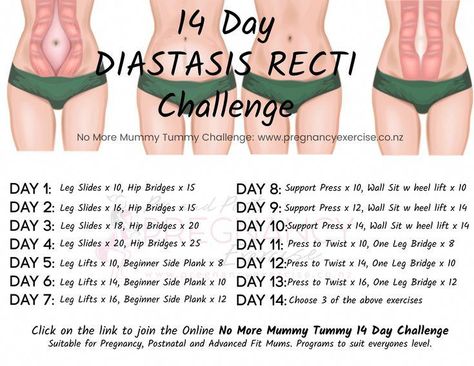 Want to heal Diastasis Recti?: Need motivation? Here is a 14 day program guide to help motivate you. Click on the link to join our 14 day No More Mummy Tummy Challenge, next round starts soon. Make sure you repin and save this one! #diastasisrecti Safe Core, Diástase Abdominal, After Baby Workout, Healing Diastasis Recti, Post Baby Workout, Postpartum Workouts, Postpartum Workout, Mummy Tummy, Diastasis Recti Exercises