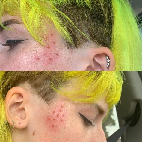 Acne Tattoo, Color Freckles Tattoo, Freckle Tattoo Ideas, Colored Freckles Tattoo, Cosmetic Tattooing, Subtle Face Tattoos, Star Freckle Tattoo, Tattoo Freckles, Colorful Freckles Tattoo