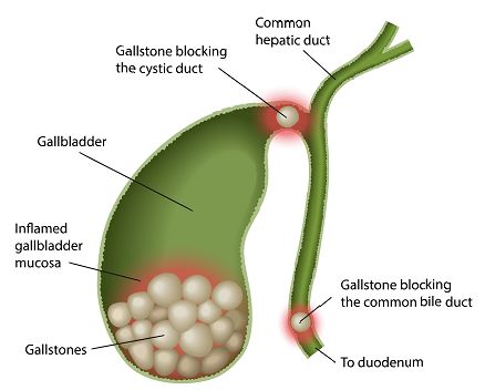 Salivary Gland Infection, Digestive System Infographic, Abdominal Regions And Organs, Organ Meat Supplement, Gallbladder Stones, Gallbladder Attack, Gut Health Infographic, Gallbladder Surgery, Eating Schedule