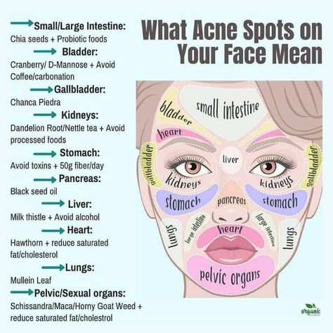 Food For Acne, Probiotic Foods, Home Doctor, Large Intestine, Acne Spots, Health And Beauty Tips, Improve Health, Health Facts, Body Health