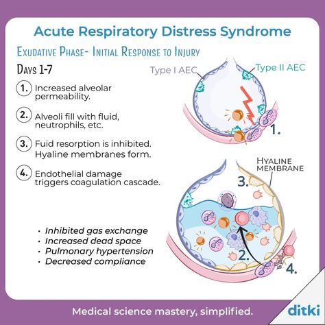 ARDS is characterized by acute dyspnea, hypoxemia, and pulmonary infiltrates. Learn more: https://ditki.com/course/pathology/glossary/pathophysiologic-disorder/acute-respiratory-distress-syndrome #ditki #usmle #meded #medschool #medstudent #highered #mededonline #lunginflammation #pathology #acuterespiratorydistresssyndrome #respiratorypath #nursing #pance #physicianassistant #osteopath #allopath #medicine #science #healthscience #nurse #premed #mcat #mbbs Hypoxemia Nursing, School Cheat Sheets, Paramedic Study, Acute Respiratory Distress, Clinical Pathology, Nclex Practice Questions, Gas Exchange, Respiratory Distress, Nurse Education