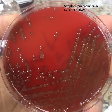 Streptococcus pneumoniae_SC_BA_SY_ZADH Streptococcus Pneumoniae