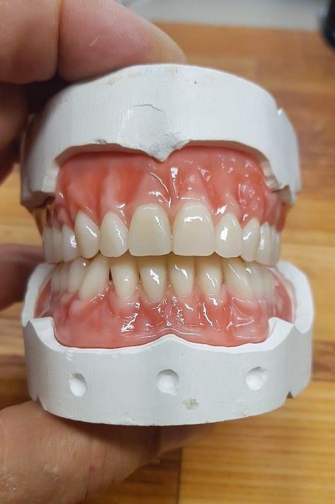 Denture Drawing, Complete Denture, Teeth Model, Dental Photos, Dental Images, Dental Posters, Dental Aesthetics, Dental Hygiene School, Dentistry Student