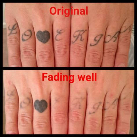 These finger tattoos have started fading away nicely. My client wants to keep the loveheart. www.the-missing-ink.co.uk  #LovingTheFade #GetRidOfYourInk #DoingItProperly #TattooRegret #TattooRemoval #LaserTattooRemoval #MissingInk #TheMissingInk #Romiley #Woodley #Stockport #Manchester #Cheshire #NorthWest Finger Tattoos Fade, Inner Finger Tattoo, Small Wave Tattoo, Palm Tattoos, Cool Arm Tattoos, Magic Tattoo, Healing Tattoo, Tattoos For Black Skin, Make Tattoo