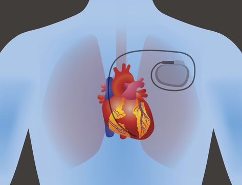 Slow Heart Rate, Human Physiology, Vegan Probiotics, Natural Face Cleanser, Heart Blocks, Medical School Essentials, Coronary Arteries, Natural Therapy, Cardiology