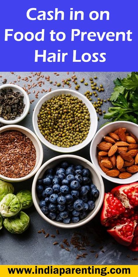 Cash in on Food to Prevent Hair Loss Foods For Healthy Hair, Foods For Hair, For Healthy Hair Growth, Health Hair, Hair Nutrition, Strong And Healthy, For Healthy Hair, Well Balanced Diet, Nutrition Guide