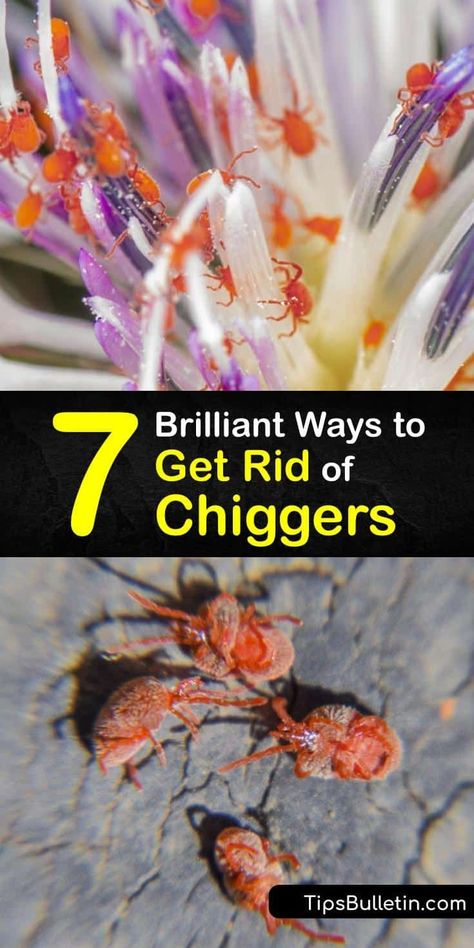 Discover how to get rid of chiggers and treat annoying chigger bites with these amazing and effective techniques. Chiggers Get Rid Of Bites, How To Get Rid Of Chiggers In Yard, How To Get Rid Of Chiggers, Chiggers Remedy, Chiggers Get Rid Of In Yard, Chigger Bite Remedy, Cat Remedies, Ant Bites, Diy Herbal Remedies