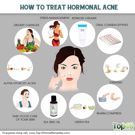 how to treat hormonal acne Treat Hormonal Acne, Acne Diet, Forehead Acne, Skin Tea, Natural Acne Remedies, Natural Acne, Acne Problem, Hormonal Acne, Cystic Acne