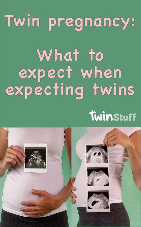 Twins Announcement, Having Twins, Pregnant With Twins, Pregnancy Guide, Expecting Twins, Twin Pregnancy, Twin Mom, How To Have Twins, Baby Coming