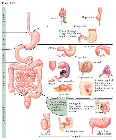 Superior Mesenteric Artery Syndrome, Superior Mesenteric Artery, Parasitic Worms, Large Bowel, School Science Projects, Medical Notes, Metabolic Disorders, Bile Duct, Digestive Tract