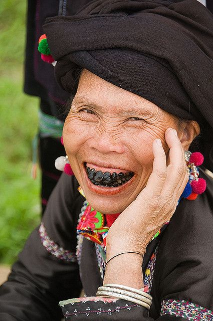 Vietnam | The black teeth of a Black Lu hilltribe woman in Tam Duong | ©Dave Stamboulis Faces Around The World, Black Teeth, We Are The World, People Of The World, Many Faces, World Cultures, Happy Face, Smile Face, Beautiful Smile