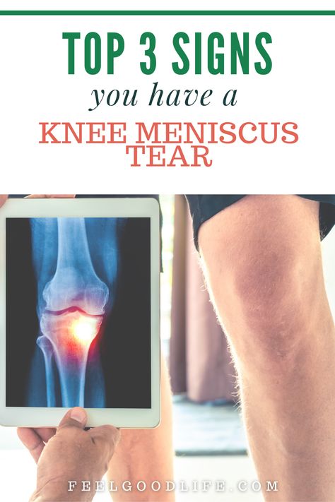 Knee Meniscus, Aching Knees, Knee Pain Relief Exercises, Inner Knee Pain, Knee Ligaments, Knee Strengthening Exercises, How To Strengthen Knees, Knee Pain Exercises, Knee Problem