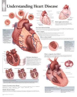 Ischemic Heart Diseases, Heart Health Month, Educational Chart, Anatomy Poster, Heart Diseases, The Human Heart, Cardiac Nursing, Human Body Anatomy, Coronary Arteries