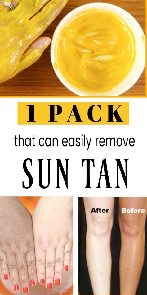 #SuntanRemoval #SuntanRemovalTips Suntan removal remedies how to remove sun tan from hands how to remove tan from face for womens sun tan removal cream how to remove tan from face for mens how to remove tan from feet how to remove old tan from face how to remove tan from neck how to remove tan from forehead Tan Removal Remedies, Tan Removal Home Remedies, Remove Tan From Face, Tan Removal Face Pack, Skin Tan Removal, Sun Tan Removal, Natural Bleach, Instant Tan, Skin Face Mask