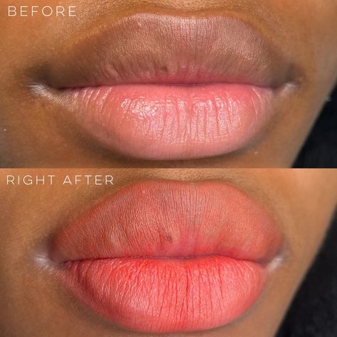 Dark Lip Neutralization, Lip Blushing Tattoo Before And After, Lip Neutralization, Blush For Dark Skin, Natural Pink Lips, Lip Blushing, Esthetician School, Dark Lip, Lip Blush