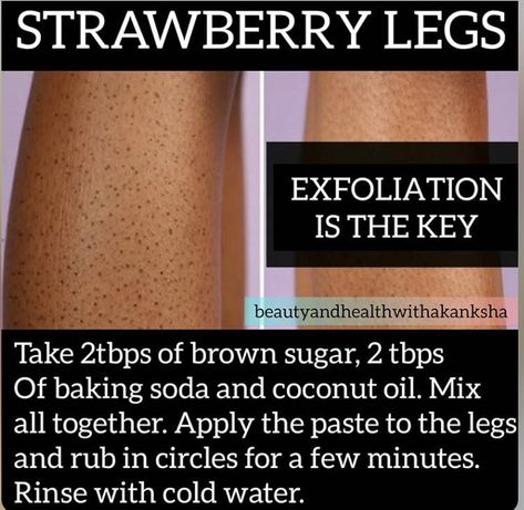 Strawberry Skin, Strawberry Legs, Soft Legs, Natural Skin Care Ingredients, Bad Acne, Natural Skin Care Remedies, Beautiful Skin Care, Good Skin Tips, Foot Scrub