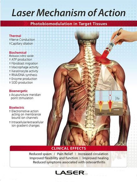 Cold lasers work on many levels and not only heal, but prevent disease and injury, especially when you add reflex integration. Decompression Therapy, Meridian Points, Cold Laser Therapy, Low Level Laser Therapy, Spinal Decompression, Power Plate, Complex Regional Pain Syndrome, Laser Therapy, Chiropractic Care