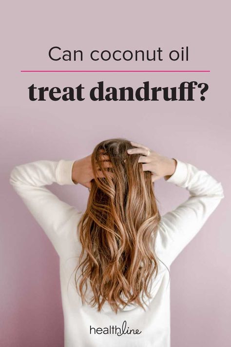 Coconut Oil For Dandruff, Coconut Oil Hair Mask Diy, Treat Dandruff, Hair Mask For Dandruff, Oils For Dandruff, Diy Coconut Oil, Coconut Oil For Acne, Coconut Oil Hair Mask, Coconut Oil For Face