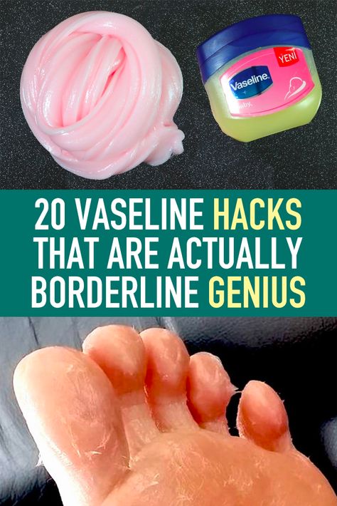 Vaseline Hacks, Vaseline Uses, Vicks Vaporub Uses, Uses For Vicks, Vicks Vaporub, Beauty Regimen, Unwanted Hair Removal, Unwanted Hair, Health And Beauty Tips