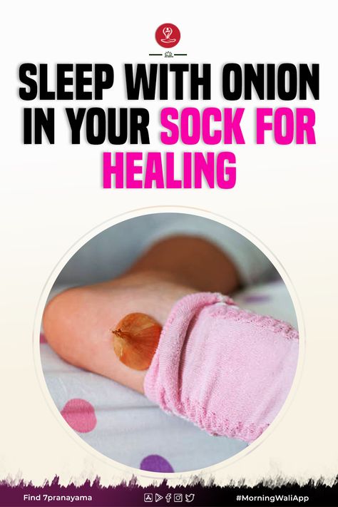 Benefits Of Onions In Socks, Onion Sock Remedy, Garlic In Socks Sleep, Garlic Socks Remedy, Onions For Colds Remedies, Onion In Sock Remedy For Sickness, Onion On Feet For Cough, Onions In Room For Sickness, Onion Poultice Chest Congestion