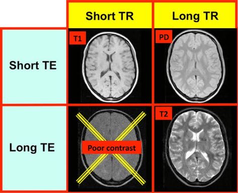 Mri Technologist, Ultrasound Sonography, Mri Brain, Radiology Student, Radiology Imaging, Bells Palsy, Anatomy Bones, Brain Surgeon, Radiology Technologist