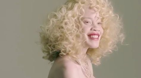 AdWeek Albino Model, Albino Girl, Black Femininity, Hozier, Burt's Bees, Hair Reference, True Story, Aphrodite, Lipsticks