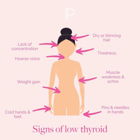 Learn all about low thyroid symptoms, hypothyroidism symptoms, thyroid health, thyroid testing and understanding of how the thyroid works, what treatments are available and which foods are best for low thyroid. Low Thyroid Symptoms, Thyroid Test, Low Thyroid, Thyroid Symptoms, Thyroid Gland, Thyroid Health, Natural Remedies, Signs, Health