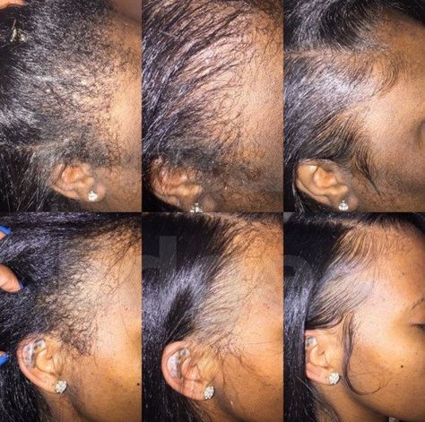 Edges can make or break a hairstyle, and unfortunately, a lot of natural and relaxed ladies struggle with keeping their edges tamed and slicked how they want them to be. There are tons of products dedicated to edge maintenance, but let’s be honest–some of them just don’t work, and even some of our favorite products … Gorilla Snot, Edges Laid, Styler Hair, Daughter Black, Healthy Relaxed Hair, Edges Hair, Bald Spot, Edge Control, Hair Regimen