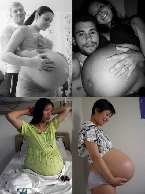 Pregnancy Collage Huge Pregnant Belly Twin, Triplet Pregnancy Belly, Triplets Pregnancy Belly, Quadruplets Belly, Twins Pregnancy Belly, Pregnant Triplets, Quintuplets Pregnancy, Pregnant With Triplets Belly, Twins Belly