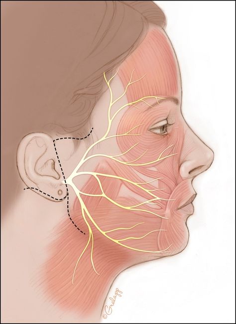 Facial Paralysis, Hand Reflexology, Facial Nerve, Human Anatomy And Physiology, Medical Anatomy, Anatomy And Physiology, Reflexology, Human Anatomy, Chinese Medicine