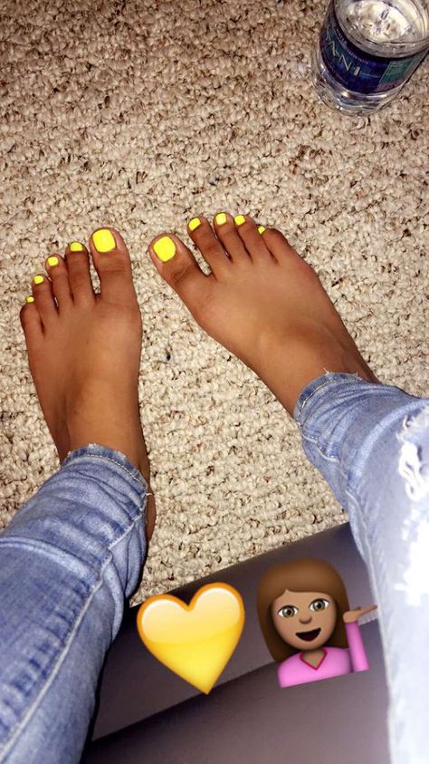 Yellow Toes Black Women, Toes Black Women, Yellow Toes, Heels Tumblr, Graffiti Wallpaper Iphone, Pretty Toe Nails, Cute Toe Nails, Finger Nails, Cute Toes