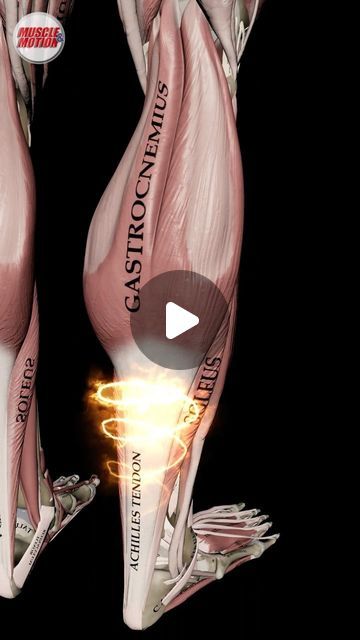 395K views · 23K likes | Muscle and Motion on Instagram: "Unveiling: The Power of the Achilles Tendon! 🚀  We're thrilled to share our latest animation on the amazing Achilles tendon! 🌟  Experience how this extraordinary tendon operates like a dynamic spring, showcasing the marvels of human anatomy.  Anatomy Insight 🦴  The Achilles tendon, a robust fibrous cord, links your calf muscles to your heel bone, playing a pivotal role in every step you take.  Function Focus 🦵  The Achilles tendon functions like a powerful spring, storing and releasing energy with every movement.   🏋️‍♂️ Strengthening the Achilles: ✅ Engage in exercises that challenge the tendon to store and release energy. ✅ Enhance the "stretch-shortening" cycle, crucial for dynamic activities like running. ✅ Incorporate plyo Calf Anatomy, Leg Muscles Anatomy, Achilles Tendon Ruptures, Muscles Anatomy, Plyometric Exercises, Leg Anatomy, Release Energy, Muscle Movement, Achilles Tendon