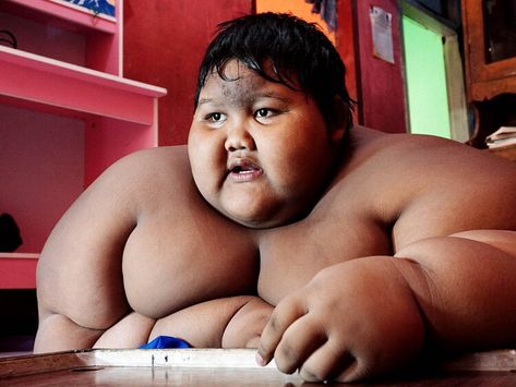 ‘World’s fattest boy’ is now unrecognisable — news.com.au Minecraft Facts, Indian Funny, Funny Dance, Excess Skin, Copyright Music, After Life, Simon Cowell, Documentary Film, World Records