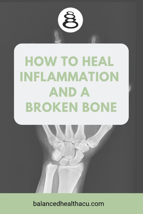 How to Heal Inflammation and a Broken Bone — Balanced Health Acupuncture - Marion, MA Bone Healing Foods, Broken Fibula, Strengthen Joints, Wrist Fracture, Ankle Recovery, Heal Inflammation, Heal Broken Bones, Fracture Healing, Knee Bones