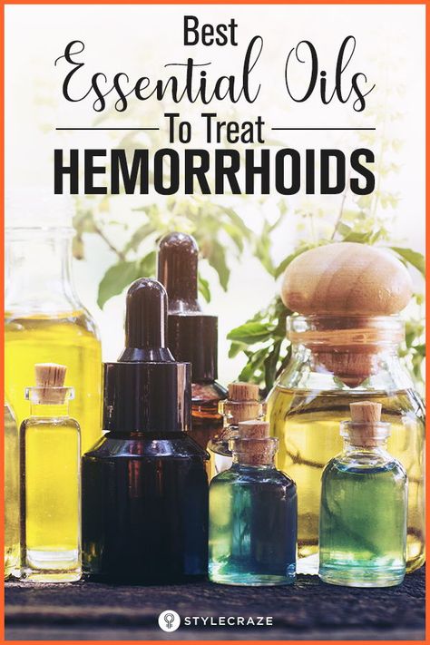 Essential Oils: The Best Way To Treat Hemorrhoids #health #wellness Essential Oils For Hemmoroids, Hemorrhoid Remedies, Hemorrhoid Relief, Top Essential Oils, Essential Oil Education, Healing Essential Oils, Chamomile Essential Oil, Best Essential Oils, Doterra Essential Oils